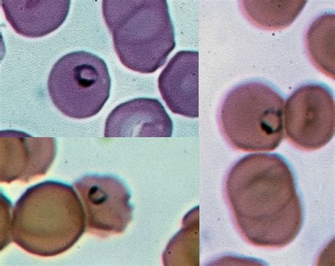   Hemosporidium! ส่องลึกปรสิตตัวจิ๋วแอบแฝงในเซลล์เม็ดเลือดแดงของสัตว์