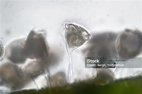  Vorticella! A Whirlwind of Microscopic Beauty and Underwater Acrobatics