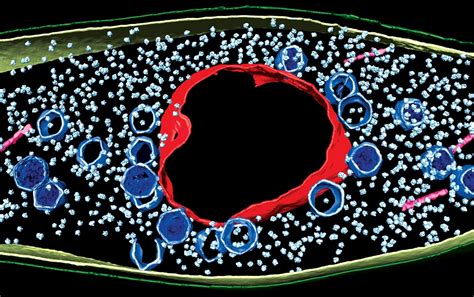  Xenosporidium! Discover This Curious Single-Celled Parasite That Can Hijack a Whole Cell and Its Fate