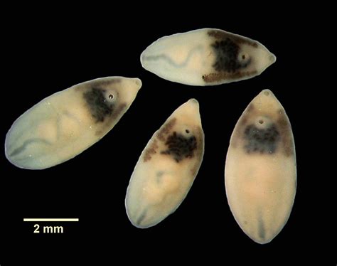  Metorchis conjunctis! Discover the Fascinating Lifestyle of This Miniature Fluke Lurking in Freshwater Fish